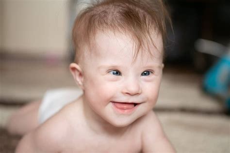 Deti s Downovým syndrómom na terapii