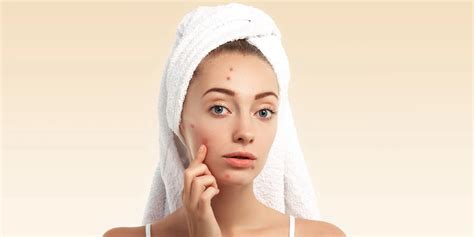 Žena podstupujúca akupunktúru