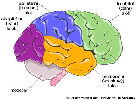 Ilustrácia znázorňujúca nesúlad medzi zrakovým vnemom a vnemom pohybu v mozgu