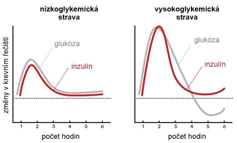 Diagram znázorňujúci priebeh cisárskeho rezu
