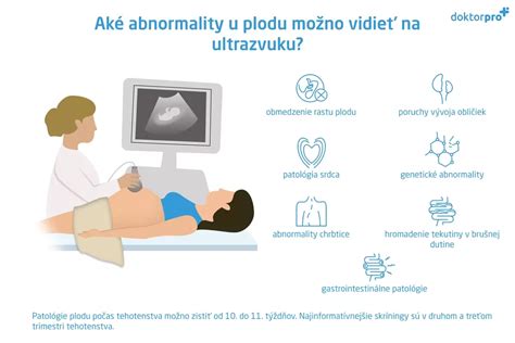 Diagram znázorňujúci hlavné orgány plodu vyšetrované pri morfologickom ultrazvuku