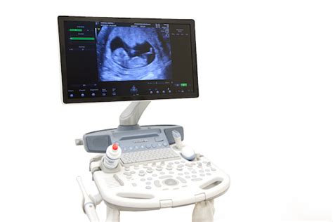 ultrazvukový prístroj na vyšetrenie plodu