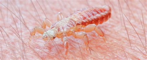 Ilustrácia vši a hnidy na vlasoch