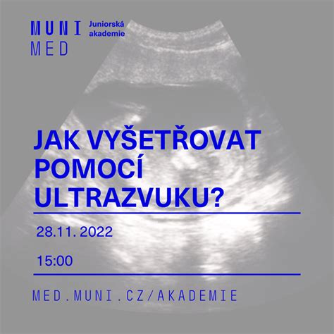 Porovnanie diagnostického a komerčného ultrazvuku
