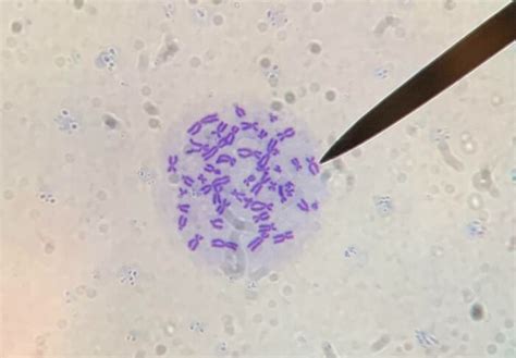 Spermia pod mikroskopom