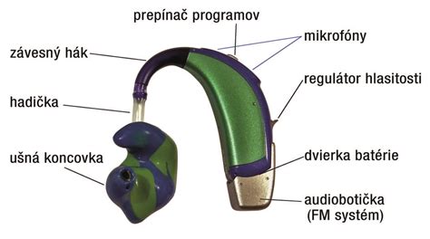 Ilustrácia načúvacieho prístroja a kochleárneho implantátu