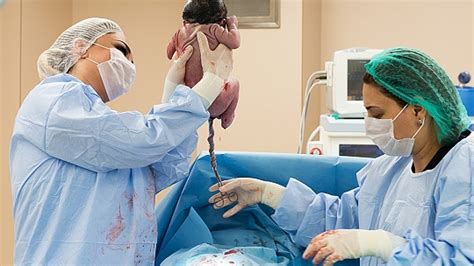 Matka dojčiaca v polosede po cisárskom reze