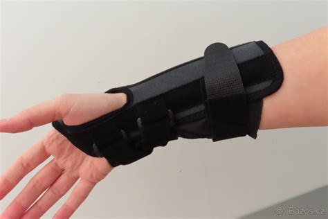 Ilustrácia remodelačnej kraniálnej ortézy (prilbičky)