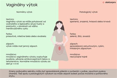 Ilustrácia znázorňujúca rôzne typy vaginálneho výtoku a ich možné príčiny