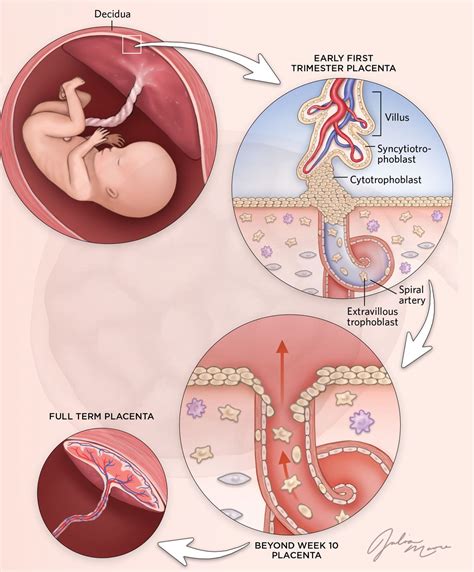 Infografika znázorňujúca embryo a maternicu s označenými kľúčovými faktormi úspešného uhniezdenia