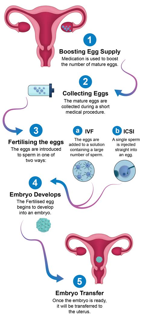 Infografika znázorňujúca proces IVF vrátane PGT a asistovaného hatchingu