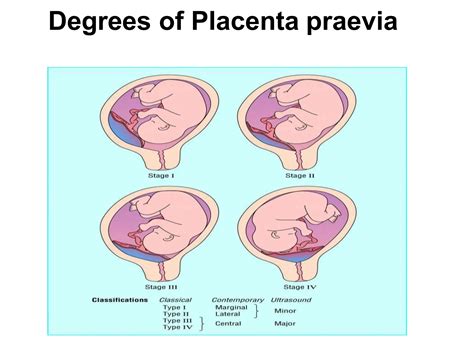 Placenta a pupočná šnúra
