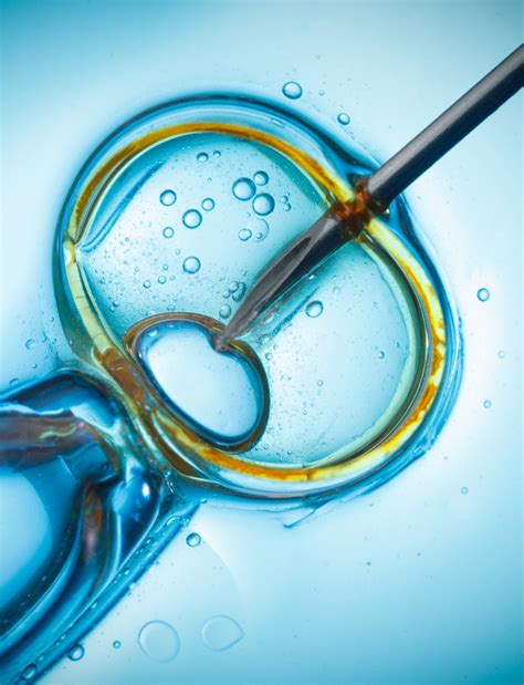 Ilustrácia metódy ICSI