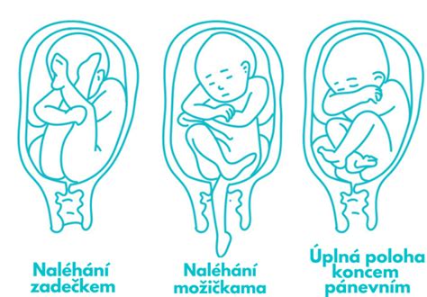 Správna poloha dieťaťa v šatke