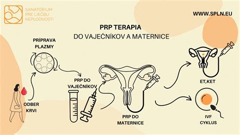 Schéma procesu IVF odberu vajíčok
