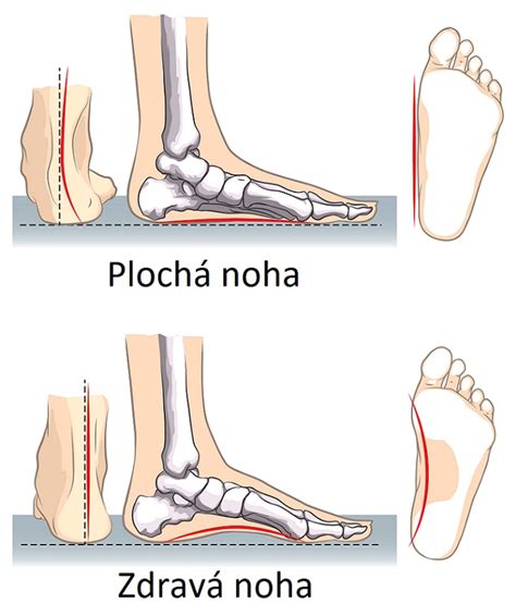 Diagram ukazujúci anatomické časti detskej nohy a ako ju topánka podporuje