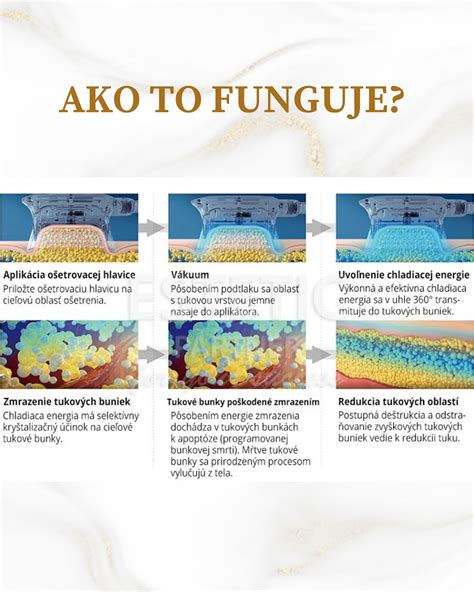 Infografika znázorňujúca účinky ultrazvukovej kavitácie na tukové bunky