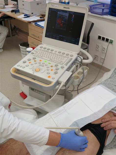 Ultrazvukové zobrazenie odberu vajíčok