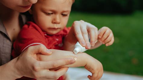 Ilustrácia prvej pomoci po uštipnutí hmyzom