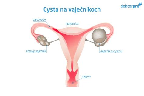Diagram ženského reprodukčného systému