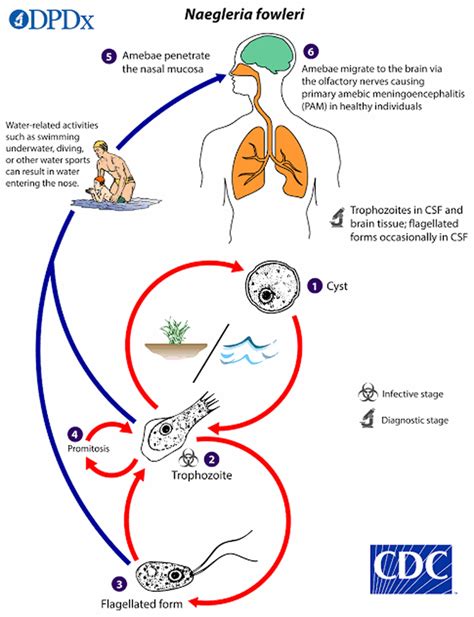 Infografika znázorňujúca postup nákazy amébou Naegleria fowleri od vdýchnutia nosom