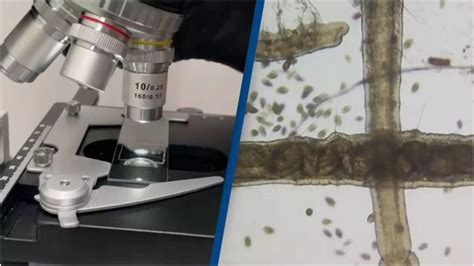 Vínna muška pod mikroskopom