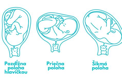 Ilustrácia vývoja plodu v maternici s placentou a plodovými obalmi