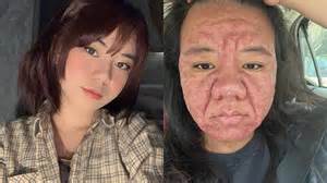 Ilustrácia ženských pŕs počas tehotenstva a laktácie