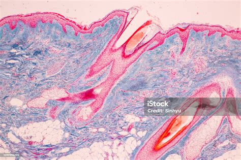 Mikroskopický pohľad na vlasové folikuly
