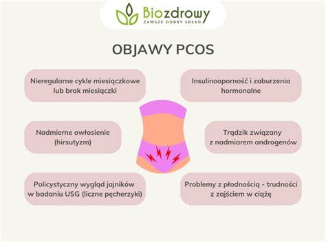 Infografika znázorňujúca PCOS