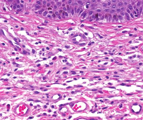 Histologický obraz endometria