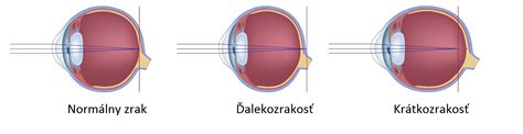 Ilustrácia oka s dioptriami