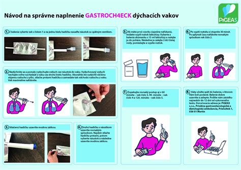 infografika o časových intervaloch cisárskeho rezu
