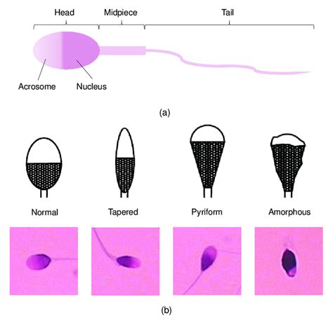 Ilustrácia cesty spermií ženským reprodukčným traktom