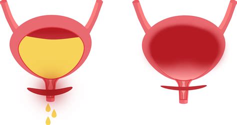 Ilustrácia ženského močového systému s vyznačenými obličkami, močovodmi, močovým mechúrom a močovou trubicou.