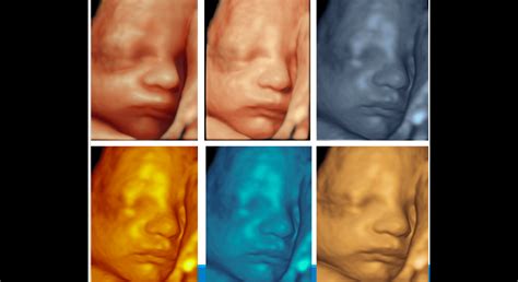 Vývoj mozgu plodu v treťom trimestri