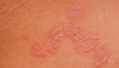 Ilustrácia Raka s dôrazom na jeho citlivú povahu