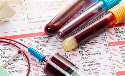 Zrážanlivosť krvi