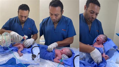 Novorodenec v rukách lekára po pôrode