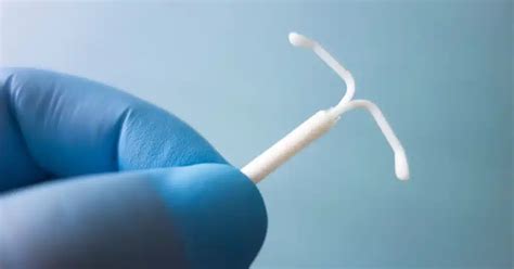 Ilustrácia vnútro maternicového telieska Mirena