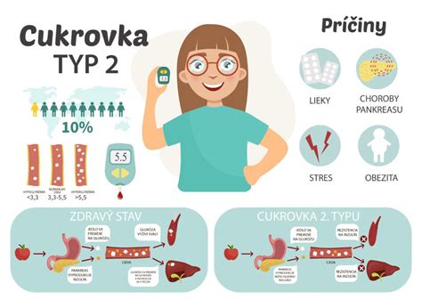 Infografika zobrazujúca rôzne typy cýst na vaječníkoch