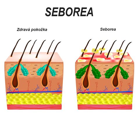 porovnanie pokožky novorodenca a dospelého