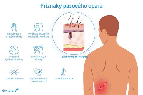 Mapa tela znázorňujúca typické oblasti výskytu pásového oparu