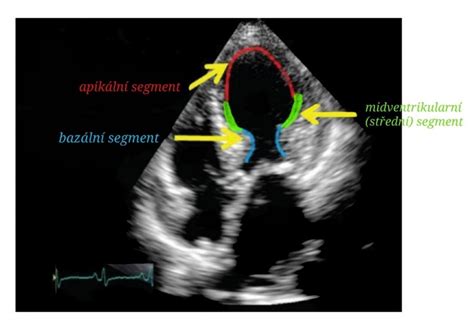 Ultrazvukové zobrazenie srdca embrya