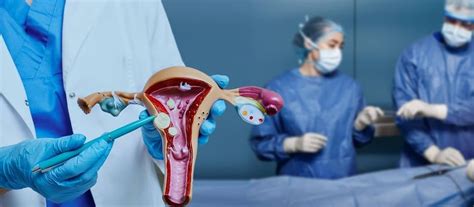 vizualizácia jazvy na maternici