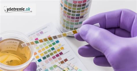 mikroskopické vyšetrenie moču