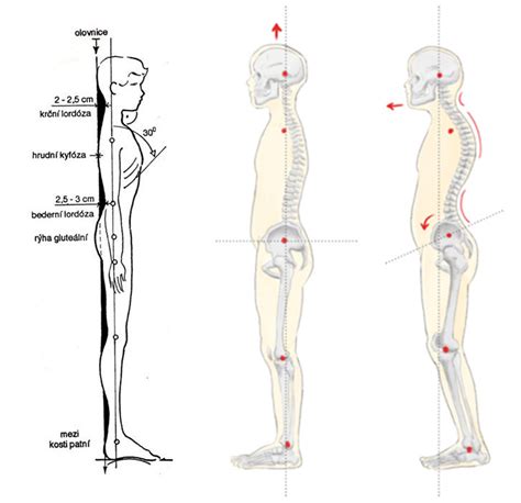 Diagram zobrazujúci správne a nesprávne prisatie dieťaťa k prsníku