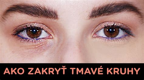 Tmavé kruhy pod očami