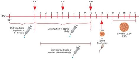 Infografika porovnávajúca dlhý a krátky protokol IVF
