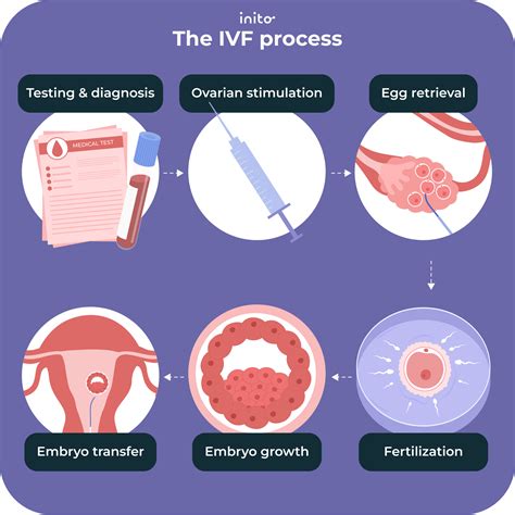 Vizualizácia procesu IVF